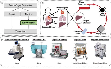Table 1 from Bioengineering approaches to organ preservation ex vivo ...