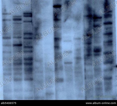 Gene Mapping Dna Fingerprint By Alec Jeffreys Album Alb