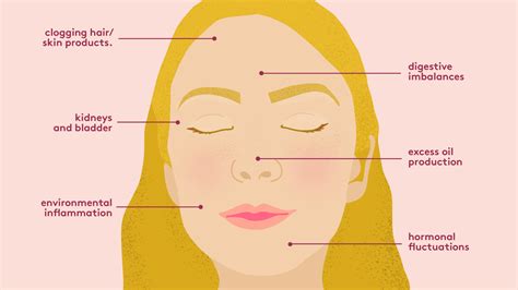 Acne Face Mapping What The Breakouts On Your Face Are Telling You