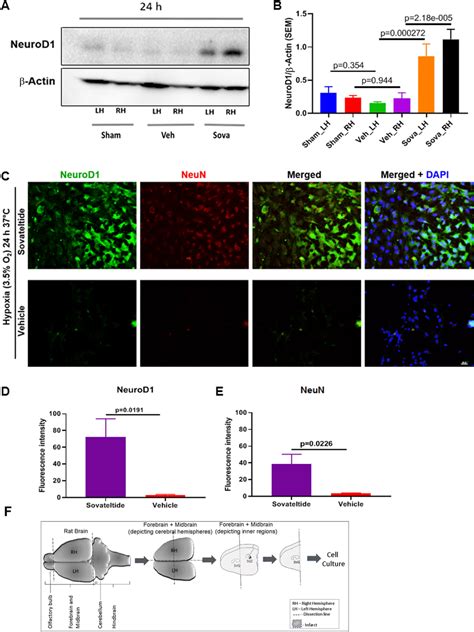 Expression Of NPCs Differentiation Marker NeuroD1 In Stroked Brain And