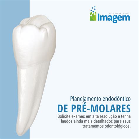 Planejamento Endodôntico de Pré-Molares - Imagem Radiologia
