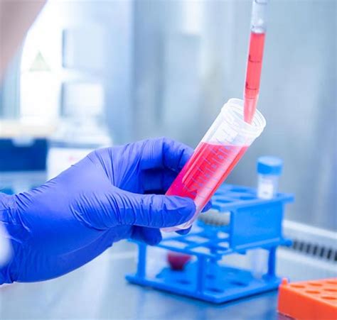 Primary Samples From Hematological Malignancies Diag2Tec