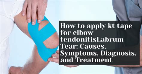 How to apply kt tape for elbow tendonitis – Alive Market