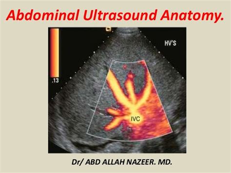 Presentation1, abdominal ultrasound anatomy.