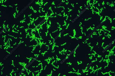 Spirochetes - Stock Image - B220/1643 - Science Photo Library