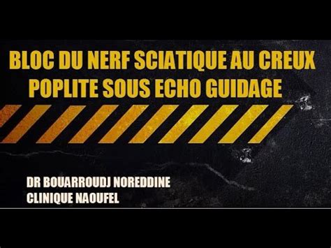 BLOC DU NERF SCIATIQUE AU CREUX POPLITE SOUS ECHO GUIDAGE YouTube