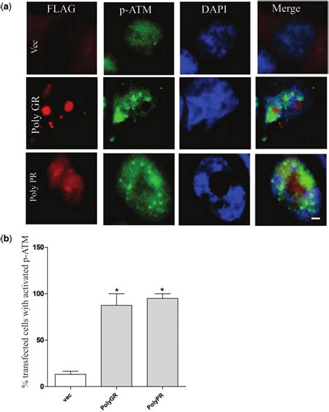 More Sh Sy Y Cells Expressing Poly Gr And Poly Pr Display