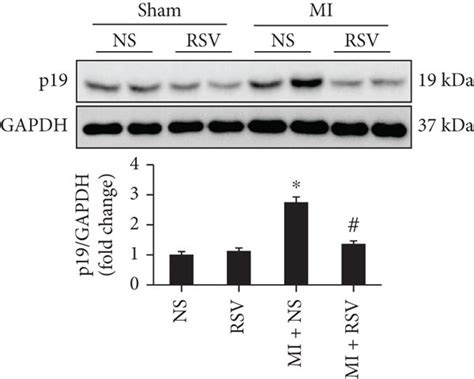 Rsv Decreased Expression Of Senescence Markers In The Mouse Heart