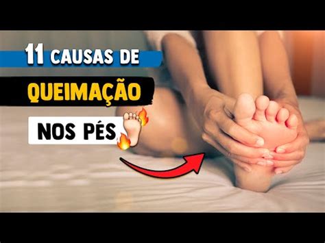 Causas De Queima O Dor E Formigamento Nos P S M Dico