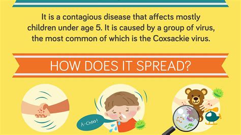 Your Complete Guide To Hfmd Infographic