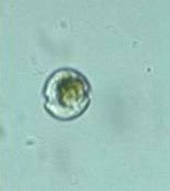 Protist Images: Glenodinium