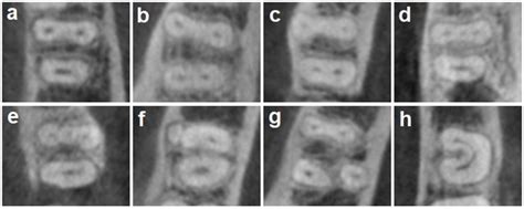 Tooth, Root, and Canal Anatomy | Pocket Dentistry