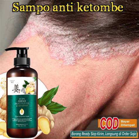 Jual Shampoo Anti Ketombe Anti Gatal Anti Kutu Shampo Rambut Rontok