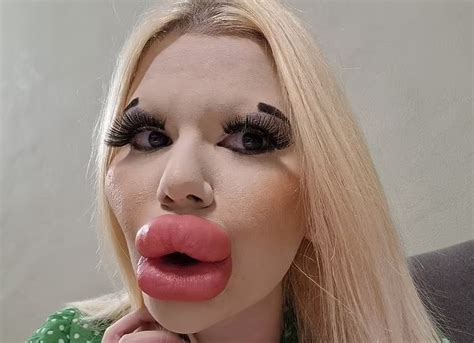 Woman With The Worlds Biggest Lips Says Men Want To Take Her On Dates And Pay For Her Trips