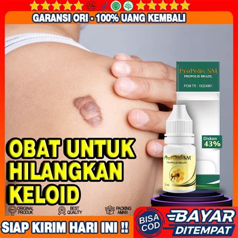 Obat Untuk Menghilangkan Homecare24