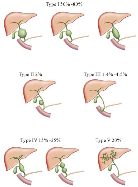 Recent Advances In Choledochal Cysts