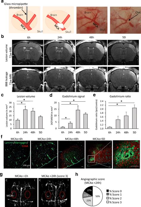 Murine Model Of Thromboembolic Stroke By Thrombin Injection A One