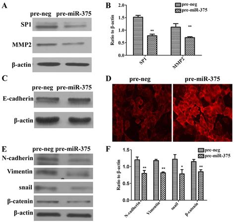 Mir 375 Inhibits The Invasion And Metastasis Of Colorectal Cancer Via Targeting Sp1 And