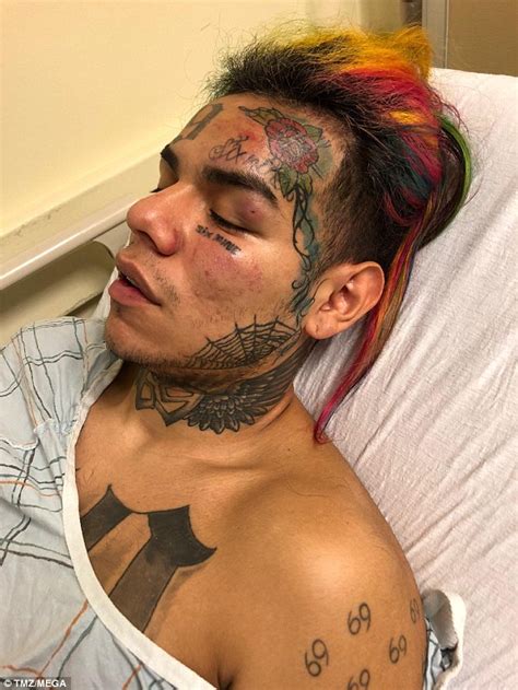 Tekashi Ix Ine Was Flaunting A Chain Before Robbery Daily