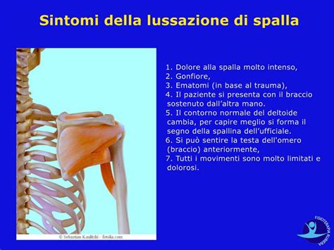 Lussazione Della Spalla I Sintomi Le Complicanze E Gli Esami Pi