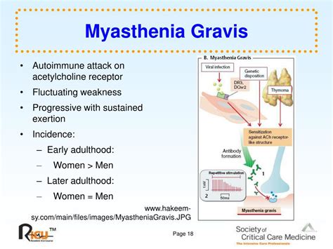 Myasthenia gravis and antibiotics use