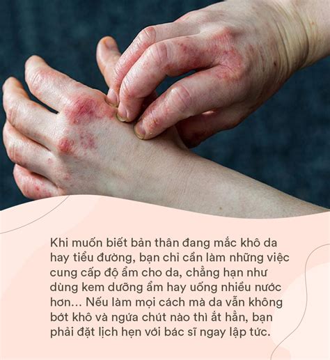 6 dấu hiệu trên da cảnh báo bệnh tiểu đường trong cơ thể