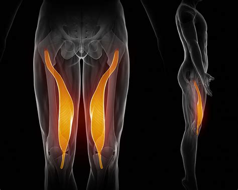 Quadriceps muscle strain or tear: Torn Quad muscle in Thigh