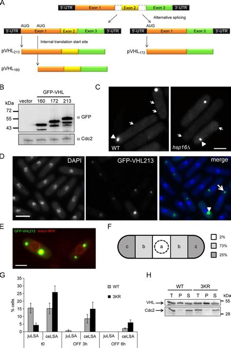 Gfp Vhl Forms Two Distinct Aggregates A Schematic Representation