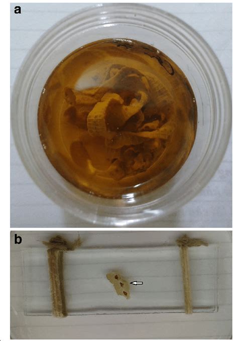 What Do Tapeworms In Human Stool Look Like