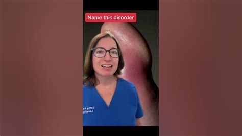 Name This Disorder 9 Medical Surgical Short Leveluprn Youtube