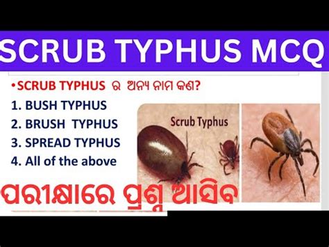 Scrub Typhus Mcq Scrub Typhus Outrage In Odisha Ri Ari Amin