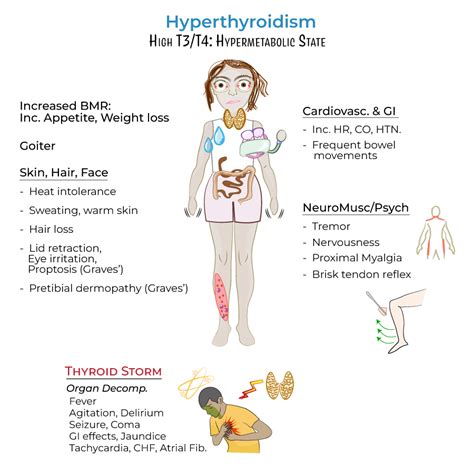 USMLE COMLEX Step 2 Glossary Thyroid Disorders For USMLE Step 2