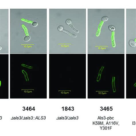 Example Micrograph Of Live C Albicans Germ Tubes Invading An Download Scientific Diagram