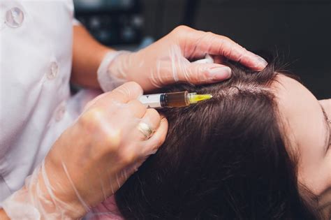 Prp For Hair Loss Landry Osteopathic Healthcare Pa Llc