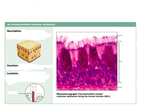 Pseudostratified Ciliated Columnar Epithelium