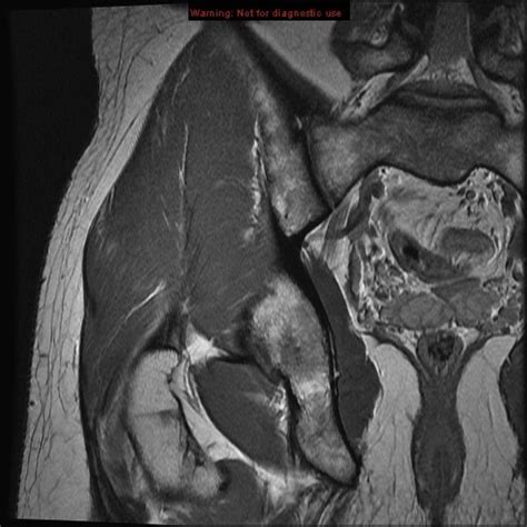 Hip MRI Anatomy Diagram | Quizlet