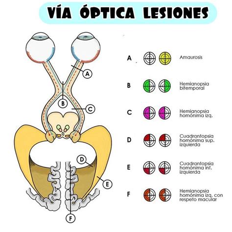 Pinterest Via Optica Quiasma Optico Optica Y Optometria