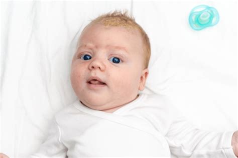 Understanding Cradle Cap Medical Associates Of Northwest Arkansas