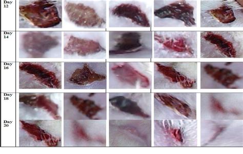 Epithialization of excision wound healing in alternative days ...