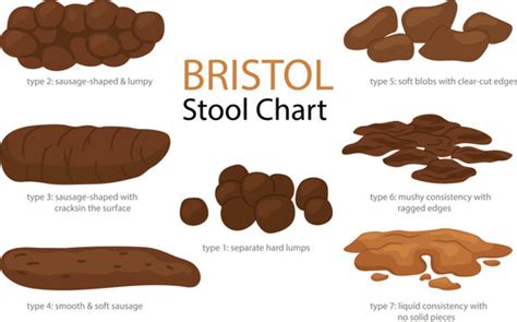 Bristol Stool Chart Overview Artofit