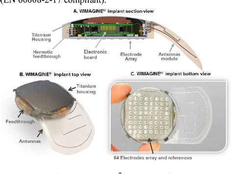 Figure 1 from WIMAGINE®: 64-channel ECoG recording implant for human ...