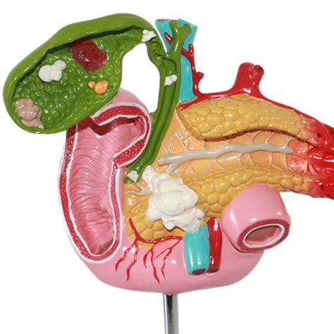 Buy Human Anatomy Science Models Viscera Pathological Model Pancreatic