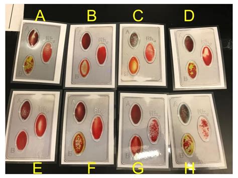 A P2 Lab Quiz Blood Types 2 22 Diagram Quizlet