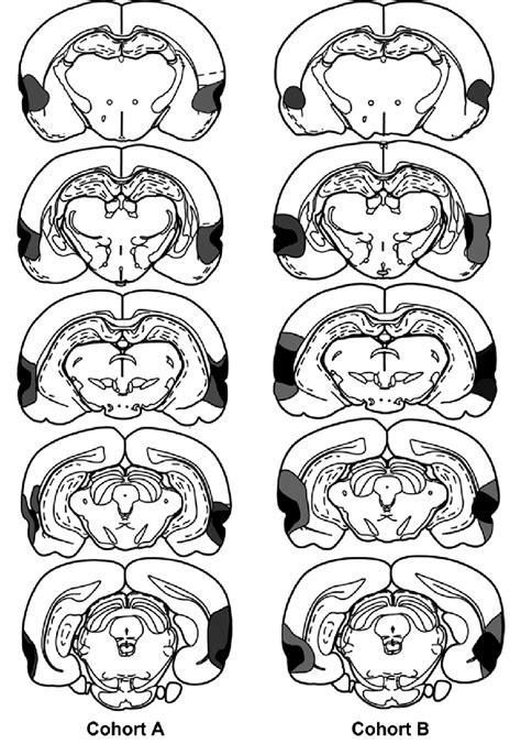 Diagrammatic reconstructions of the perirhinal cortex lesions, showing ...