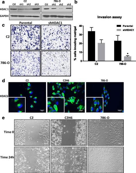 HDAC 1 And HDAC 6 Increase Cell Invasion And Migration In RCC Cells