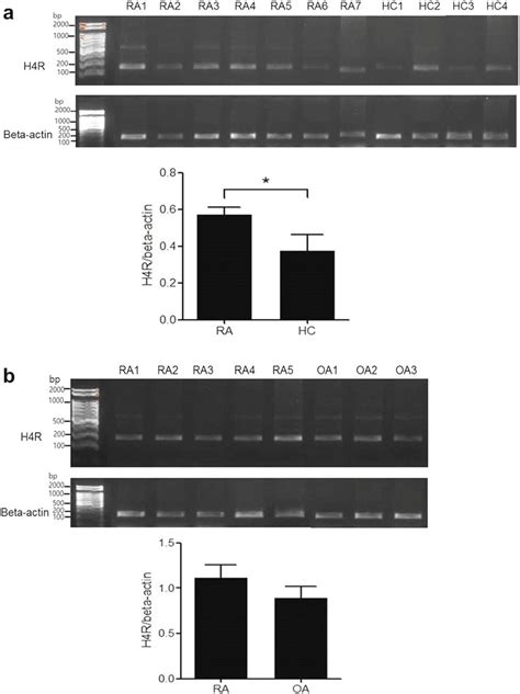 The Expression Of Histamine H4 Receptor H4R In Peripheral Blood PB