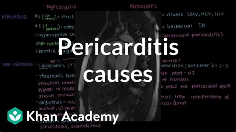 Pericarditis Causes