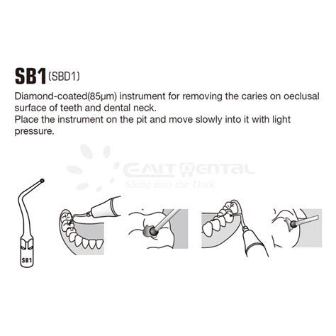 China Cavity Preparation Scaling Tip SB1 For EMS Manufacturers Cavity