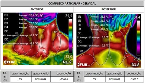 Curso De Exames Laborais TermogrÁficos Uniwallace