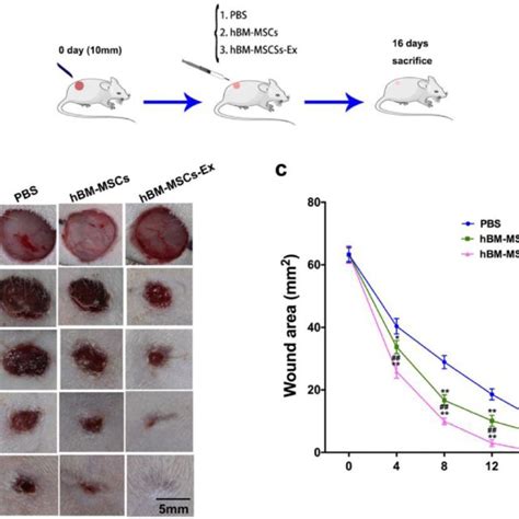 Hbm Msc Ex Treatments Accelerate Cutaneous Wound Healing Process In